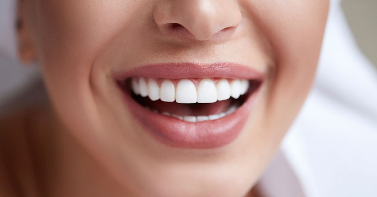 Are Porcelain Veneers Right for You? | Caven Dental Group