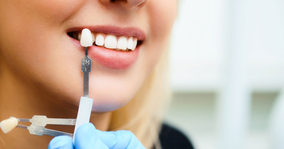 close up on mouth of smiling woman and dentist’s hand holding a crown near her teeth