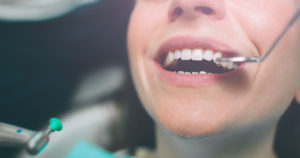 How To Fix A Broken Crown On Your Tooth