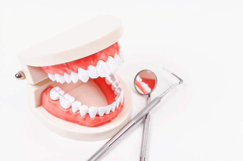 a full mouth dental implant model, for the top and bottom arch, with dental tools lying next to it