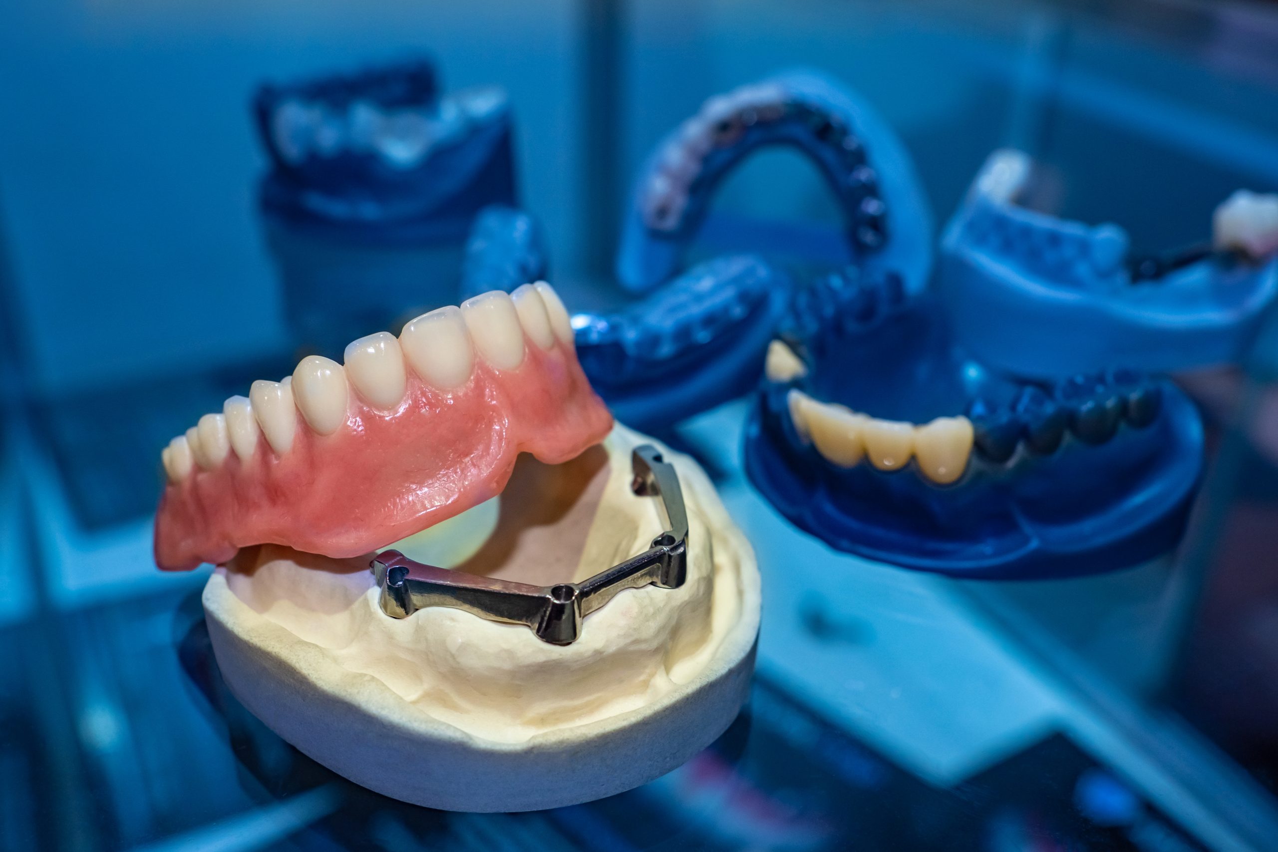 image of a dental implant denture on a prosthesis jaw in a dark and blue aesthetic dental room